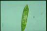 Euglena spirogyra