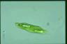 Euglena spirogyra