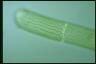 Spirogyra margaritata