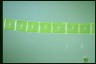 Spirogyra