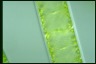 Spirogyra