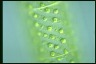 Spirogyra