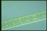 Spirogyra