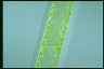 Spirogyra