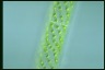 Spirogyra