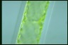 Spirogyra