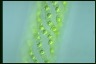 Spirogyra