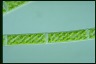 Spirogyra