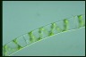 Spirogyra