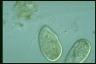 Paramecium trichium