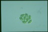 Glaucocystis nostochinearum