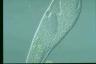 Spirostomum teres