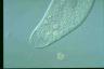 Spirostomum teres