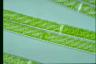 Spirogyra