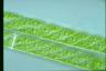 Spirogyra