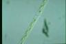 Spirogyra