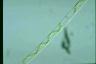 Spirogyra