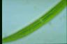 Closterium intermedium