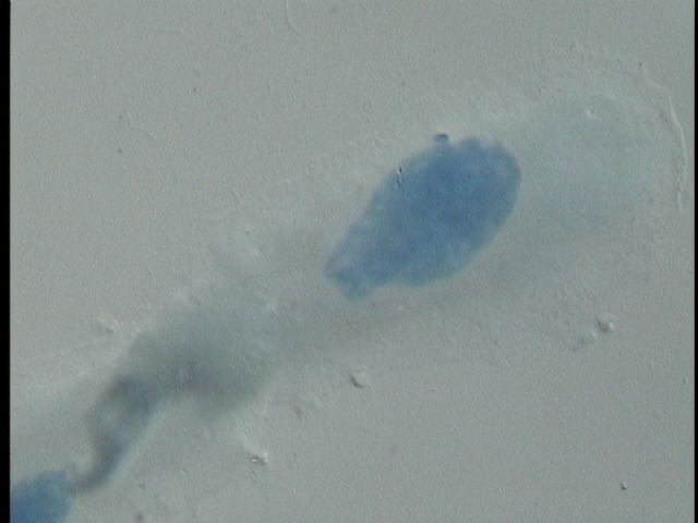 protist image