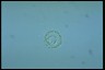 Anabaena