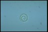 Anabaena