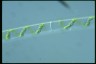 Spirogyra