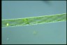 Spirogyra