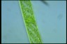 Spirogyra