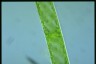 Spirogyra