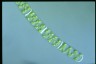 Spirogyra