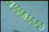 Spirogyra