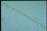 Spirogyra