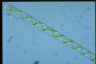 Spirogyra