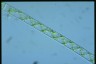 Spirogyra