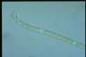 Spirogyra