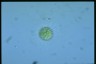 Acanthocystis penardi