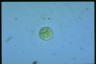 Acanthocystis penardi