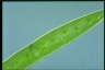 Closterium acerosum