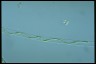 Spirogyra arta