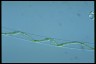 Spirogyra arta