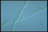 Spirogyra arta