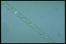 Spirogyra