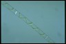 Spirogyra