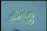 Microcystis