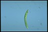 Euglena oxyuris