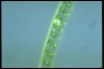 Spirogyra