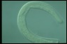 Spirostomum intermedium