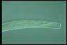 Spirostomum intermedium