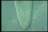 Paramecium