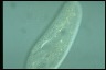 Paramecium